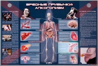 Электрифицированный стенд "Вредные привычки: алкоголизм" - «globural.ru» - Краснокамск