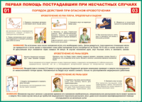 Таблица Порядок действий при опасном кровотечении 1000*1400 винил - «globural.ru» - Краснокамск